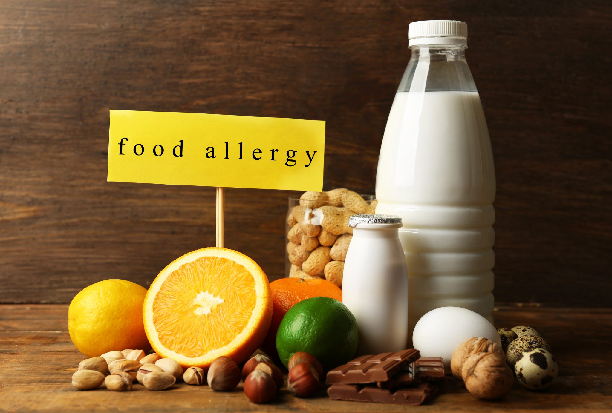 various food allergy items